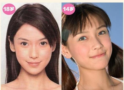 杨颖为什么不承认整容