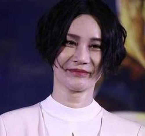 尚雯婕为什么整容