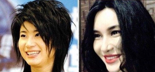 尚雯婕为什么整容