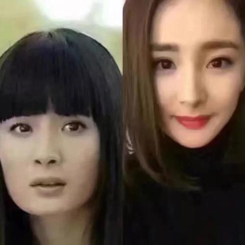 为什么有些人整容