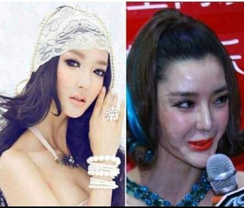 为什么有些人整容