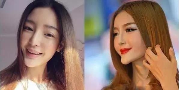 整容为什么失败了