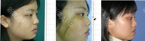 为什么整形医生不整容