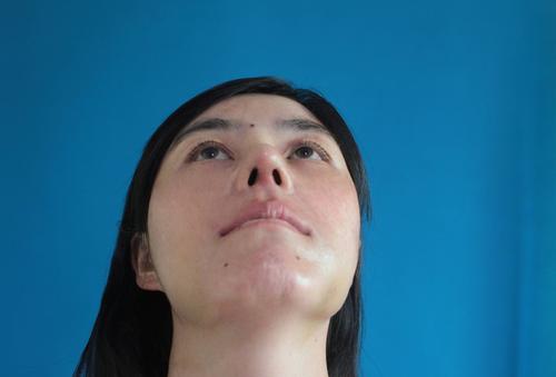 整容前为什么要验血