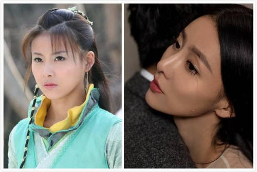 贾青很漂亮为什么整容