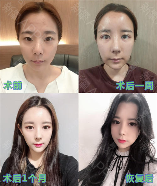 为什么整容医生不整容