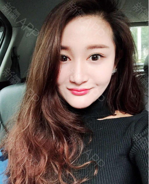 为什么整容医生不整容