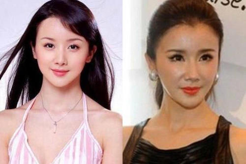 为什么整容脸会老得快