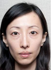 瘦脸针的危害有什么副作用